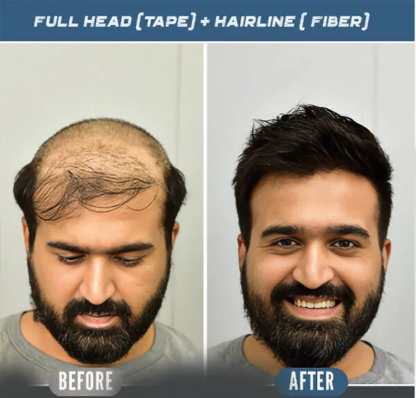 ORIGINAL Miraj Hair Patch with Real Human Hair, 7D Skin Base, Invisible Scalp, Authentic Luxury Men's Toupee. - Image 8