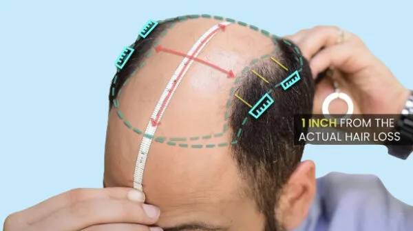 ORIGINAL Miraj Hair Patch with Real Human Hair, 7D Skin Base, Invisible Scalp, Authentic Luxury Men's Toupee. - Image 7