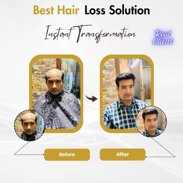 # best hair miraj hair patch oregnal miraj hair patch